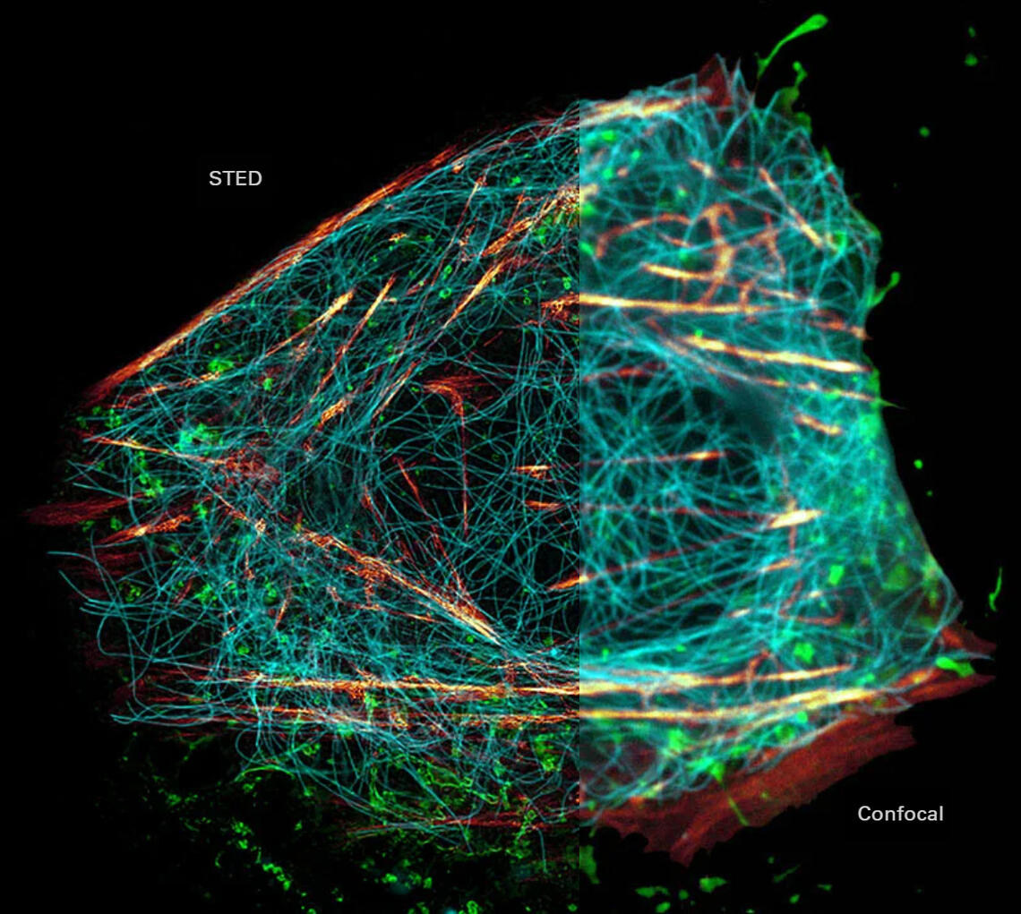 STED v Confocal