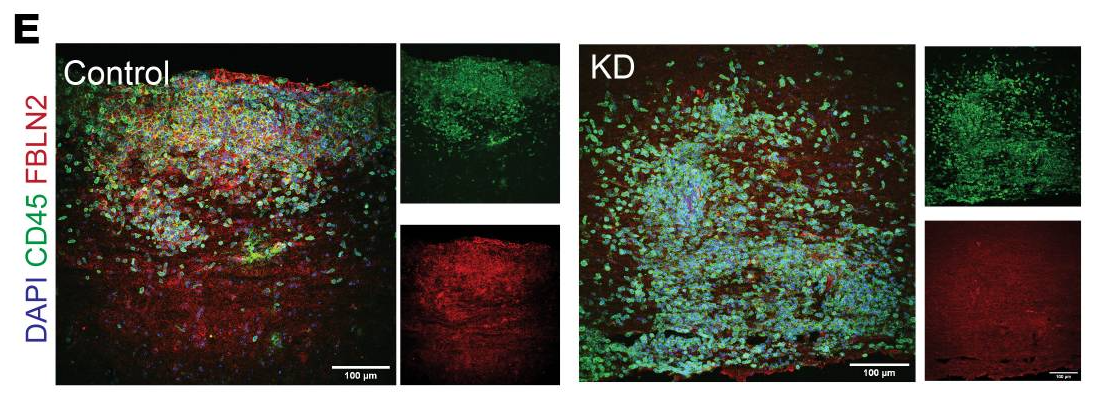 images of spinal cord sections from mice