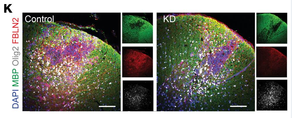 images of spinal cord sections from  mice
