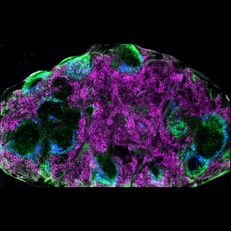 Microscopy image depicting a oncolytic virus infection of the spleen. Green around the edges, then blue and purple on the inside.