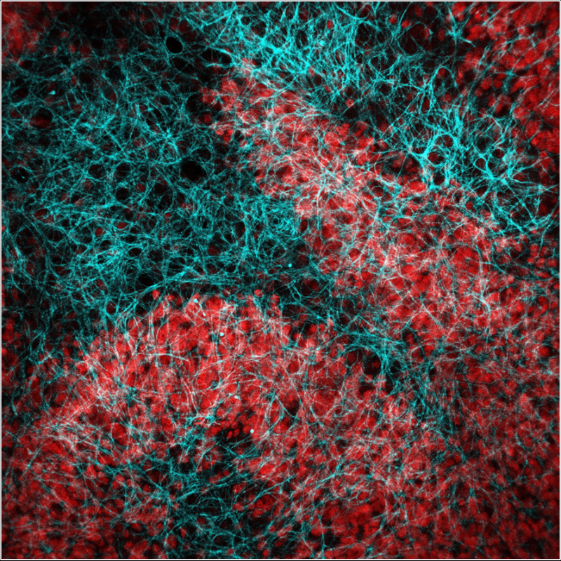 Microscopy image of mouse cerebellum tissue. Image shows red dots and blue mesh-like structure overlapping.