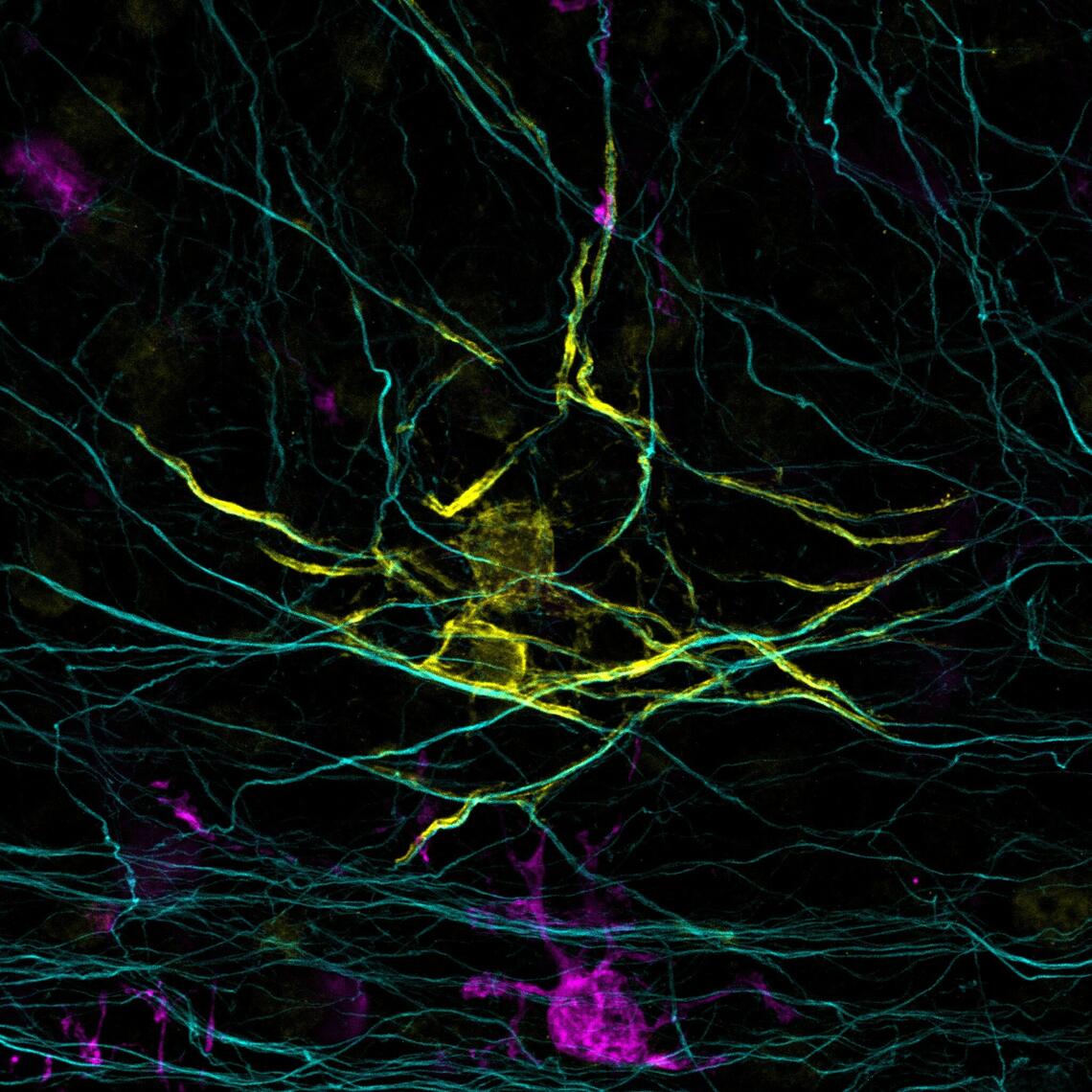 Microscopy image of the brain showing oligodendrocytes and microglia in pink.