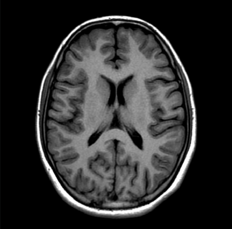 Axial view