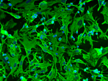 Astrocytes