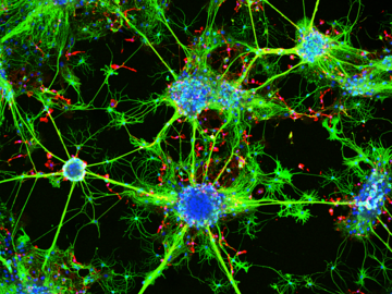 Neurons and Microglia co-culture