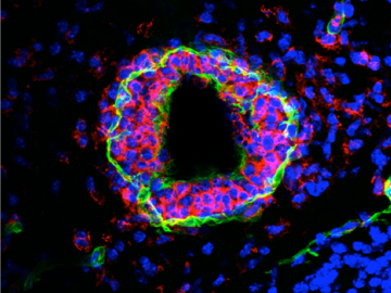 A perivascular cuff in EAE mouse cerebellum