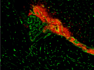 Meningeal inflammation in EAE mouse brain
