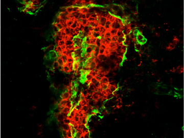 A massive perivascular cuff in EAE mouse cerebellum