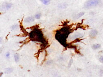 Microglia