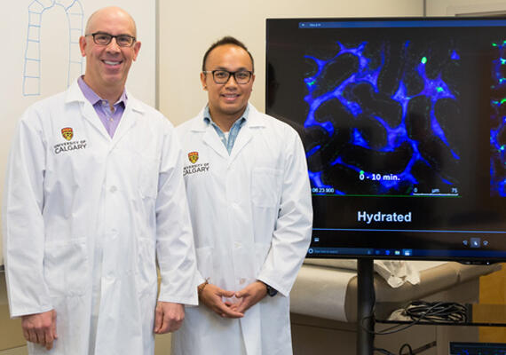 Dan Muruve, left, and his team, including postdoctoral fellow Arthur Lau, have discovered why contrast dyes in diagnostic tests can cause harm to kidneys.