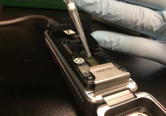 DNA sample being pipetted into an Oxford Nanopore Technologies MinION portable sequencer flowcell