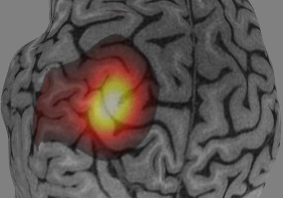 3D Brain Motor Area