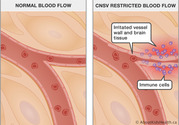blood flow