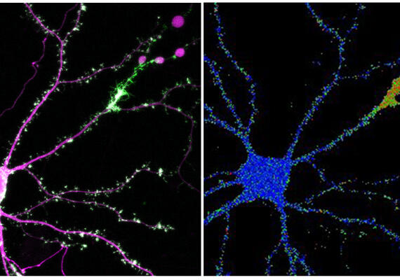 Neuron