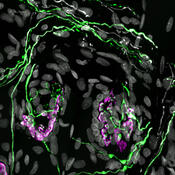 Neuromuscular junctions and axons