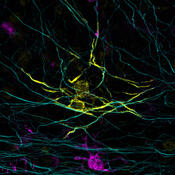 Oligodendrocyte, axons, and microglia