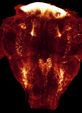 Brainstem