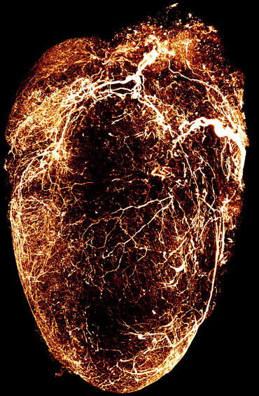 heart
