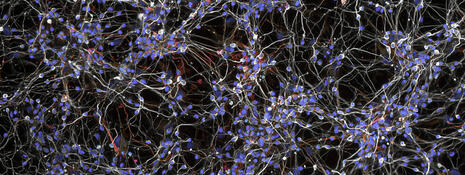 Embryonic mouse nerve cells
