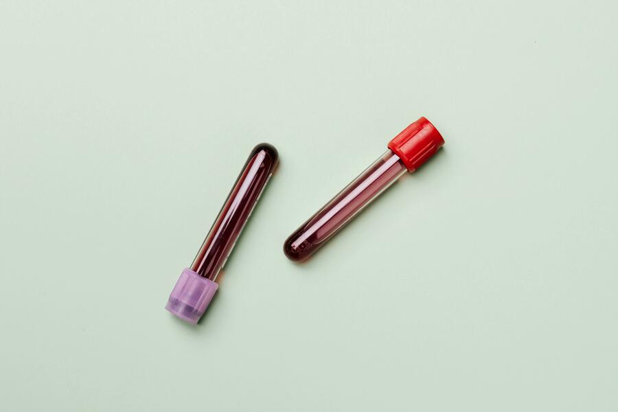 Blood Test