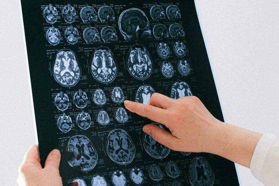 MRI films