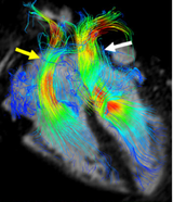 CHD_2019