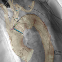 Body Interventional Fellowship