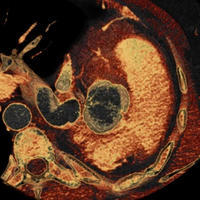 Cardiac and Thoracic Imaging Fellowship