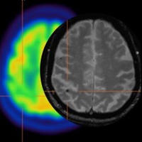 Diagnostic Neuroradiology