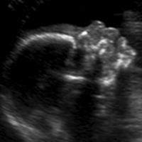 Obstetrical/Fetal Imaging Fellowship