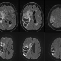 MRI Images from Clinical Trials