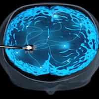 Colour cross-section of the brain