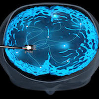 Coloured brain image