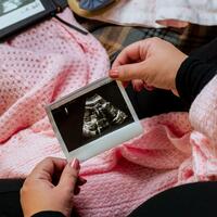 woman holding ultrasound of baby