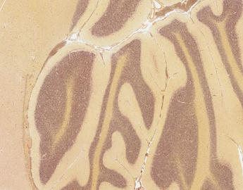 Gram stain of the cerebellum.