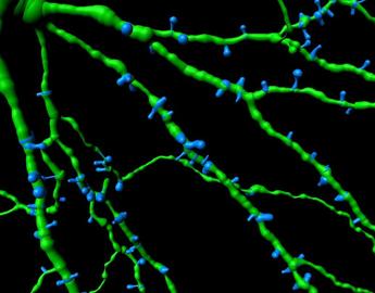 Imaris spines