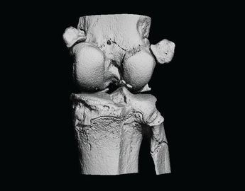 3D Bone