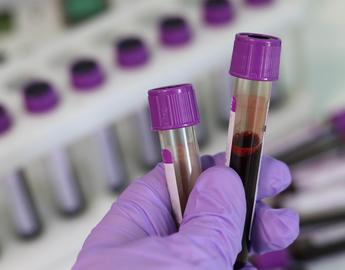 Blood tubes