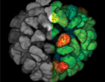 FLIM organoid