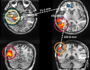 Sample of EEG-fMRI