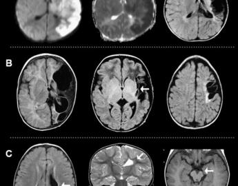 Neonatal Neuro-Critical Care Module 9