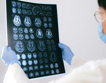 MRI brain films