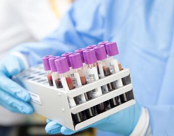 Blood samples 