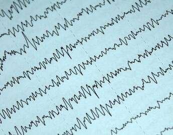 EEG