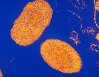 Pertussis (Whooping Cough) 